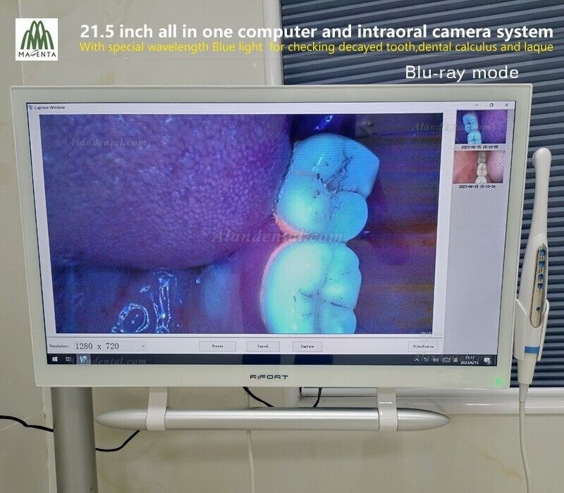 Magenta YF-2200P+ Dental 21.5 Inch Touch Screen Intraoral Camera VGA+HDMI